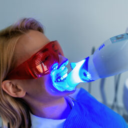Ultraviolet light procedure at dentist office